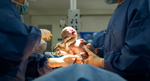 רשלנות רפואית בלידה מצוקה עוברית